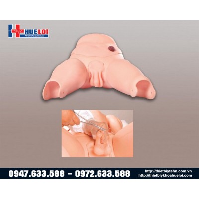 Mô hình đặt sonde tiểu nam